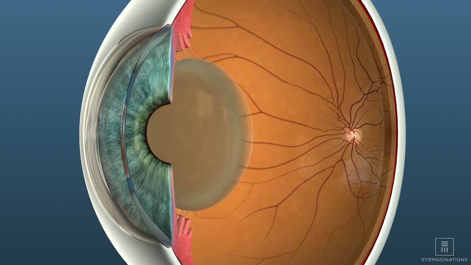 diagram of eye